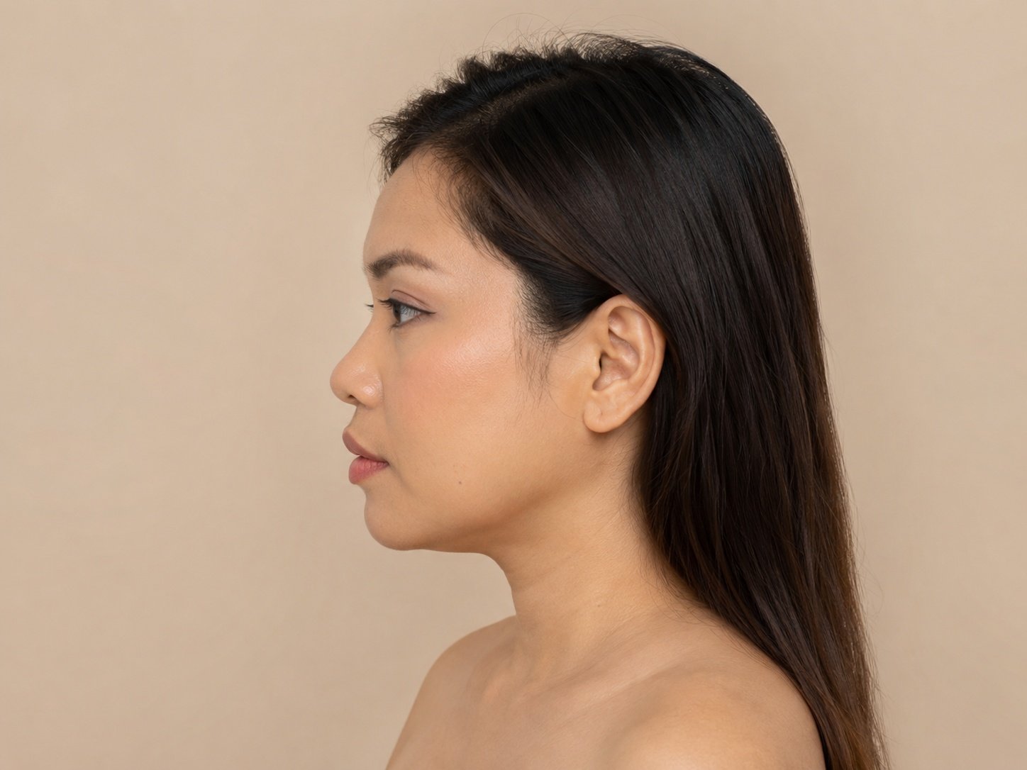 Before nose threads side profile concern